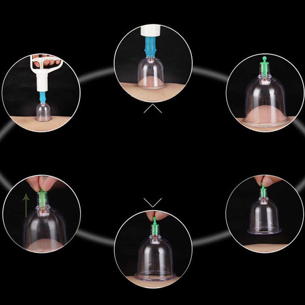 24 Vacuum Cupping Cups Kit Hom – Home Improvement In Usa Bewertung und Preis